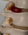 Glucosamine Sulphate