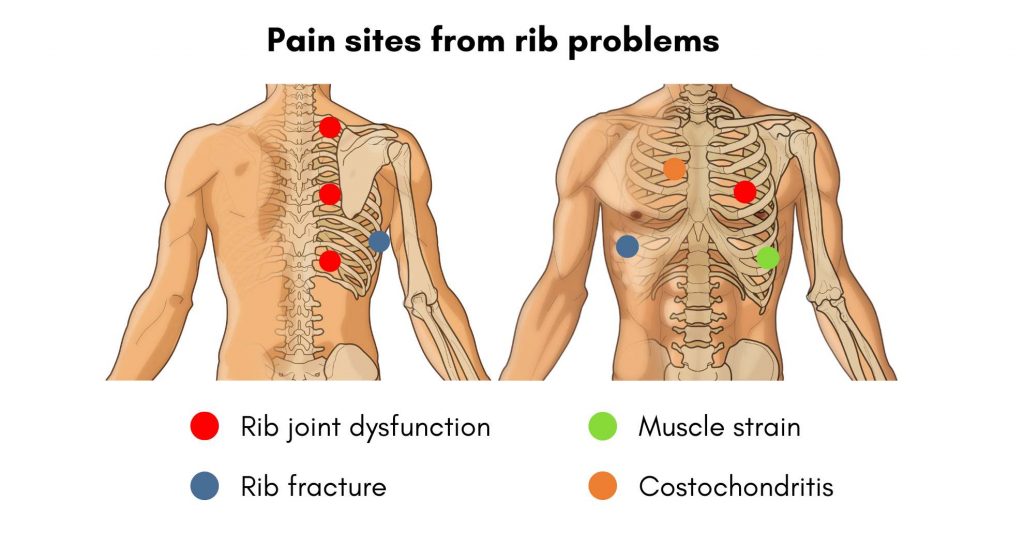 Chest Or Rib Pain? Causes and Solutions Sundial Clinics